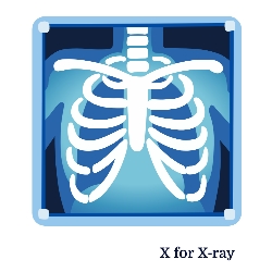 A for Apple से Z for Zebra तक – बच्चों के लिए A to Z Alphabets Chart with Pictures 29 X for X-ray